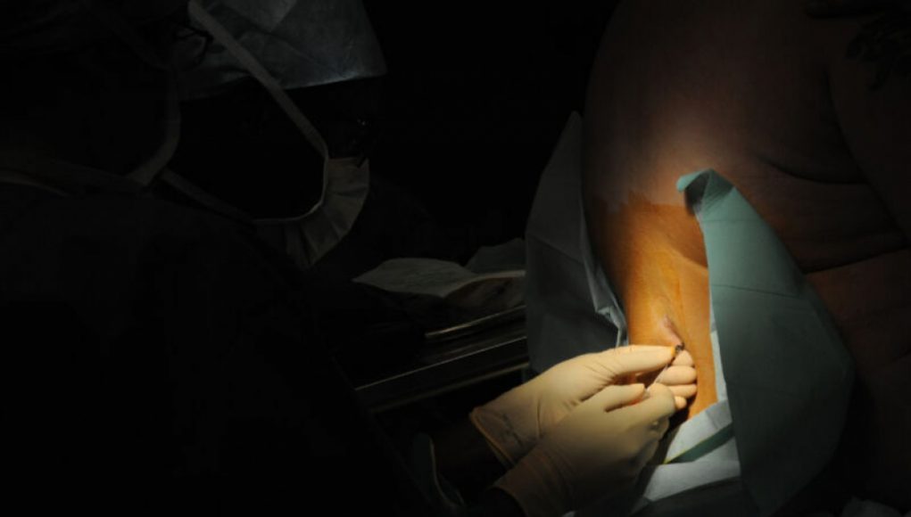 CDC Warns Against Getting Epidurals in Mexico After 40 Deaths, Including One Texan