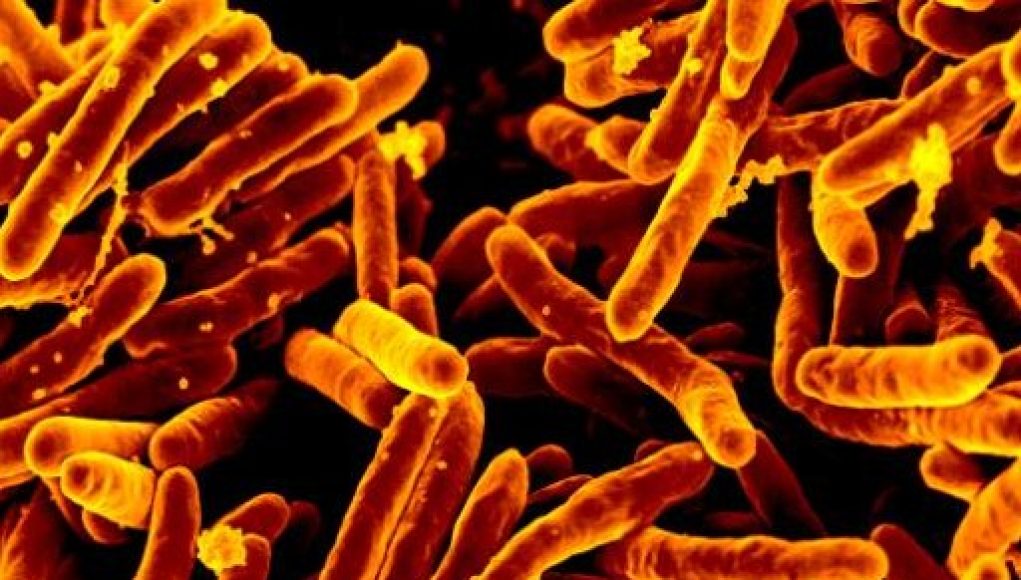 Woman with untreated TB evades arrest for three months