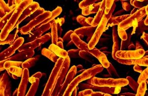 Woman with untreated TB evades arrest for three months Woman with untreated TB evades arrest for three months