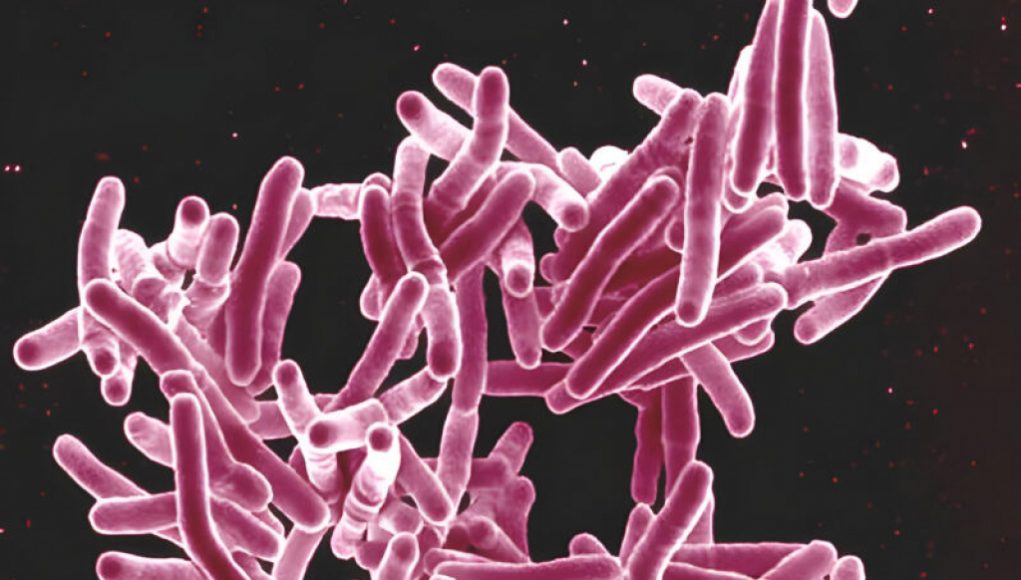 Woman with untreated TB escapes prison