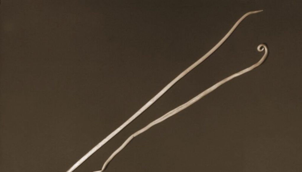 Giant Worms Cause Hazardous Traffic Jam Inside Man’s Body